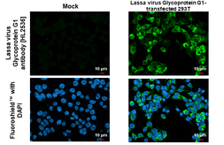Anti-Lassa virus Glycoprotein G1 antibody [HL2536] used in Immunocytochemistry/ Immunofluorescence (ICC/IF). GTX638905